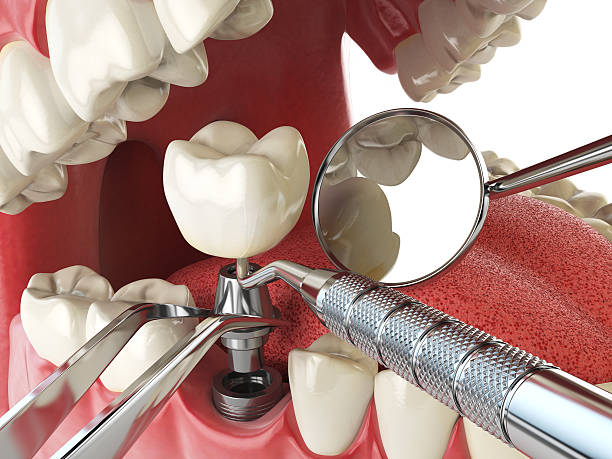 Best Emergency Tooth Extraction  in Waggaman, LA